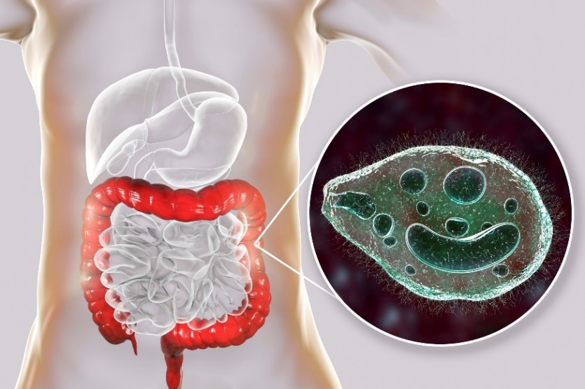 Balantidium coli - ihmisen ruoansulatuskanavan paksusuolta infektoiva loinen.