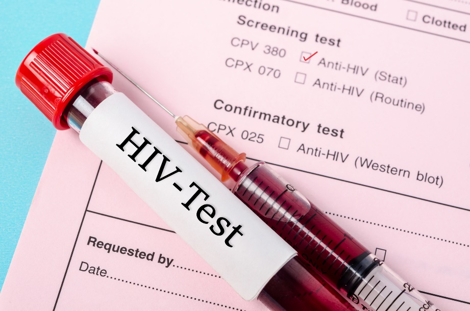 Diagnostinen testi HIV-vasta-aineiden esiintymisen toteamiseksi potilaan verinäytteessä.