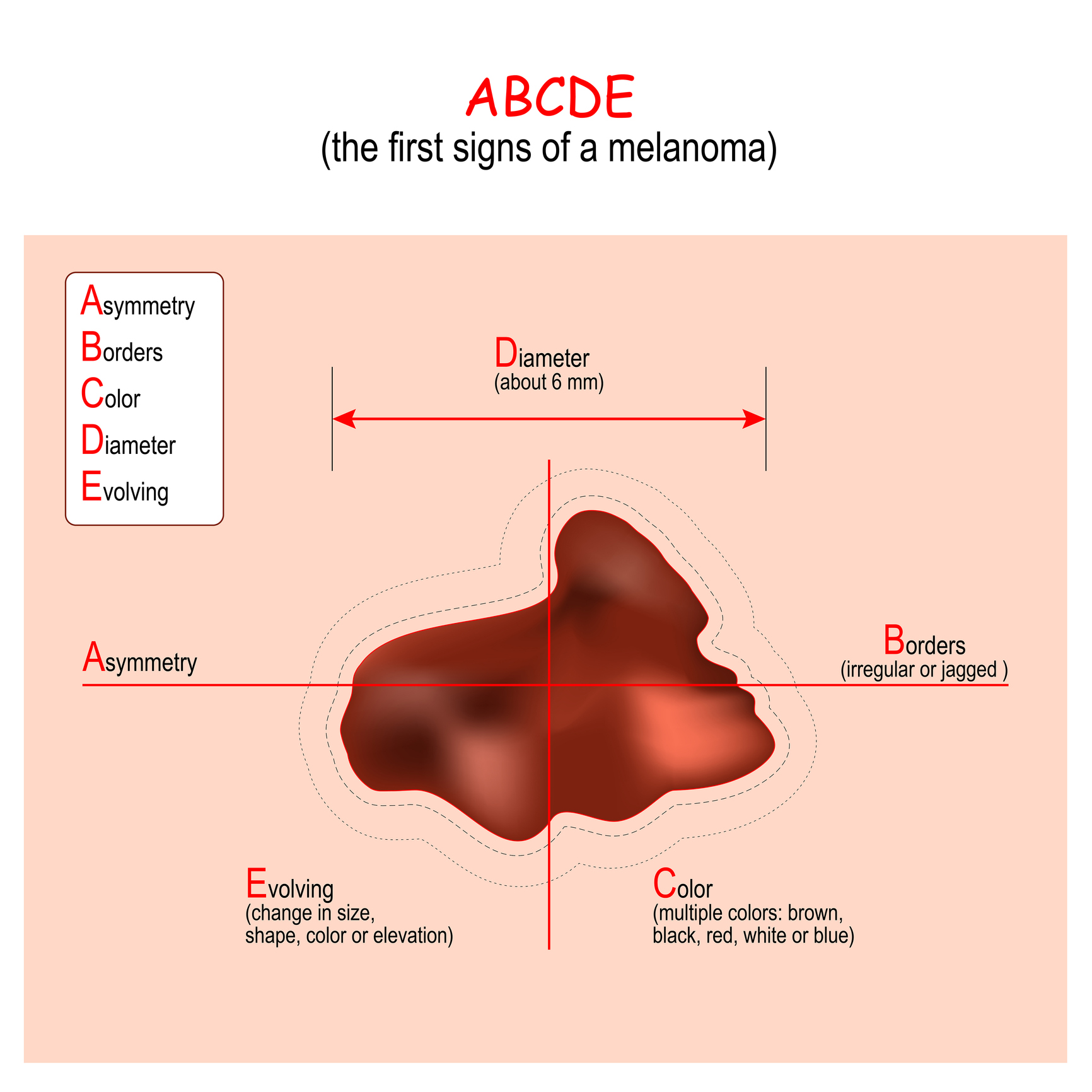 ABCDE-algoritmi