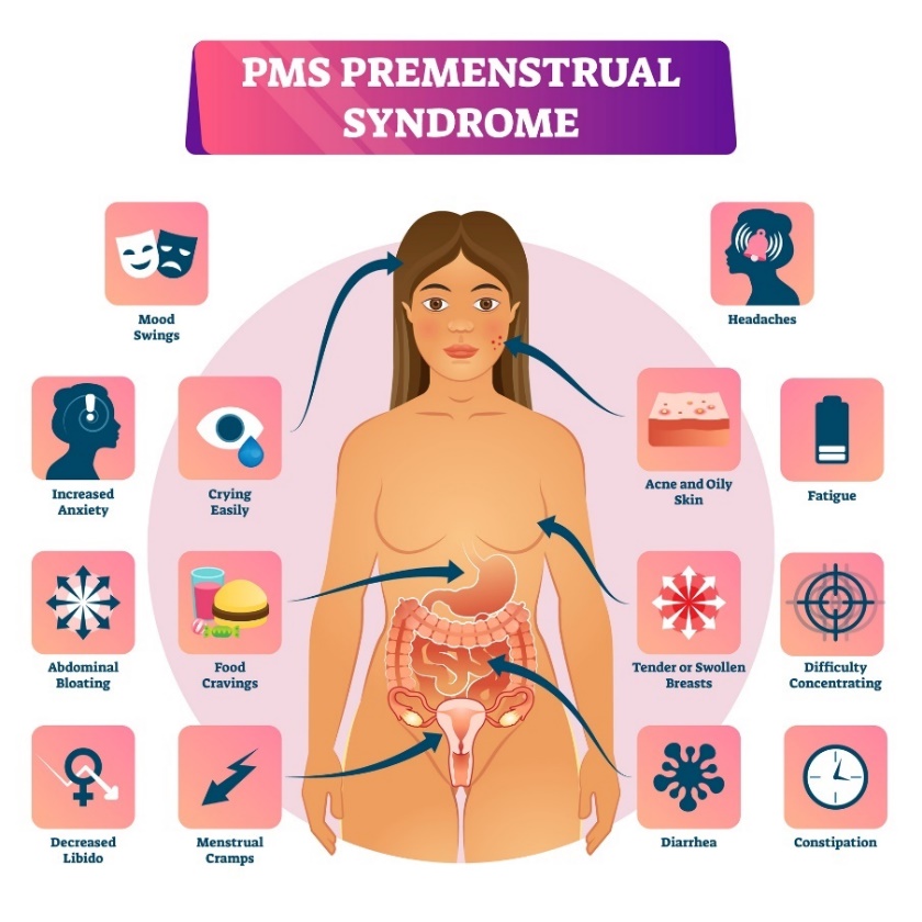 Premenstruaalinen oireyhtymä ja sen oireet