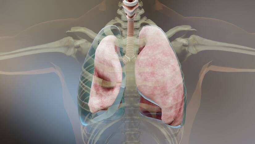 Pneumothorax (ilmaa rinnassa): syyt, oireet ja ensiapu